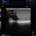 Echo-Son / ALBIT ultrasound scanner/ Images gallery / LA510 /urology