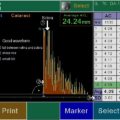 Echo-Son PIROP ultrasonograf okulistyczny - A-scan / Prawidłowy pomiar