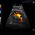 Echo-Son / ALBIT- Uniwersalny ultrasonograf / przykładowe obrazy / CA255 / Color Dopple