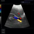 Echo-Son / ALBIT- Uniwersalny ultrasonograf / przykładowe obrazy / CA255