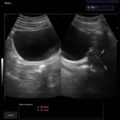 Echo-Son / ALBIT- Uniwersalny ultrasonograf / przykładowe obrazy / CA255