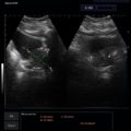 cho-Son / ALBIT- Uniwersalny ultrasonograf / przykładowe obrazy / CA255 /