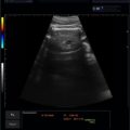 Echo-Son / ALBIT- Uniwersalny ultrasonograf / przykładowe obrazy / CA255 / pomiar FL