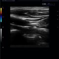 Echo-Son / ALBIT- Uniwersalny ultrasonograf / przykładowe obrazy / LA510