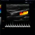 Echo-Son / ALBIT- Uniwersalny ultrasonograf / przykładowe obrazy / tryb PW