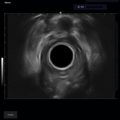 Echo-Son / ALBIT ultrasound scanner/ Images gallery / R510 /colorectal
