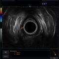 Echo-Son / ALBIT- Uniwersalny ultrasonograf / przykładowe obrazy / colorectal R510