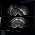 Echo-Son / ALBIT ultrasound scanner/ Images gallery / 2R575