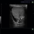 Echo-Son / ALBIT- Uniwersalny ultrasonograf / przykładowe obrazy / LA510/ urologia