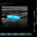 Echo-Son /EPIDOT - ultrasonograf przenośny/LA510 /Color Doppler