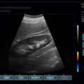 Echo-Son /EPIDOT - ultrasonograf przenośny/CA-255