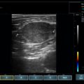 Echo-Son /EPIDOT - ultrasonograf przenośny/LA510
