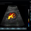 Echo-Son /EPIDOT - ultrasonograf przenośny/CA-255