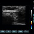 Echo-Son /EPIDOT - ultrasonograf przenośny/LA510