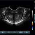 Echo-Son /EPIDOT - ultrasonograf przenośny/2R-575
