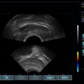 Echo-Son /EPIDOT - ultrasonograf przenośny/2R-575