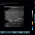 Echo-Son /EPIDOT - ultrasonograf przenośny/LA510/urologia