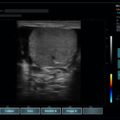 Echo-Son /EPIDOT - ultrasonograf przenośny/LA510/urologia
