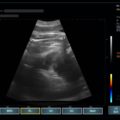 Echo-Son /EPIDOT - ultrasonograf przenośny/ CA-255 /OB