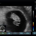 Echo-Son /EPIDOT - ultrasonograf przenośny/CA-255 /OB