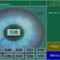Echo-Son/ PIROP ophthalmic ultrasound / CCT- Pachymeter / multi map 1