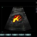 Echo-Son / SPINEL ultrasound scanner / CA255 / color Doppler