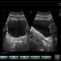 Echo-Son / SPINEL ultrasound scanner / CA255 / 2B mode