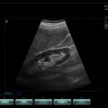 Echo-Son / SPINEL ultrasound scanner / CA255 /