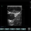 Echo-Son / SPINEL ultrasound scanner / LA510