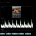 Echo-Son / SPINEL ultrasound scanner / LA510 /Color Doppler +PW