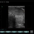 Echo-Son / SPINEL ultrasound scanner / LA510