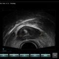 Echo-Son / SPINEL ultrasound scanner / 2R575