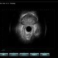 Echo-Son / SPINEL ultrasound scanner / R510
