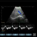 Echo-Son / SPINEL ultrasound scanner / CA255 /Doppler PW