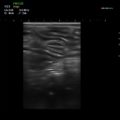 Echo-Son / ultrasonograf weterynaryjny / LA510