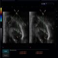 Echo-Son / ALBIT- Uniwersalny ultrasonograf / przykładowe obrazy / LA510 MSK