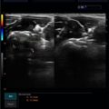 Echo-Son / ALBIT- Uniwersalny ultrasonograf / przykładowe obrazy / LA510 /