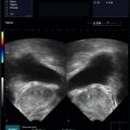 Echo-Son / ALBIT- Uniwersalny ultrasonograf / przykładowe obrazy / 2R575