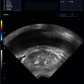 Echo-Son / ALBIT- Uniwersalny ultrasonograf / przykładowe obrazy / 2R575