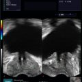 Echo-Son / ALBIT- Uniwersalny ultrasonograf / przykładowe obrazy / CV-580