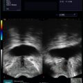 Echo-Son / ALBIT ultrasound scanner/ Images gallery / CV-580