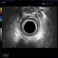 Echo-Son / ALBIT ultrasound scanner/ Images gallery / R510 /colorectal